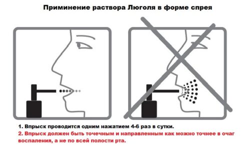 Какое обезболивающее лучше применять при ангине?